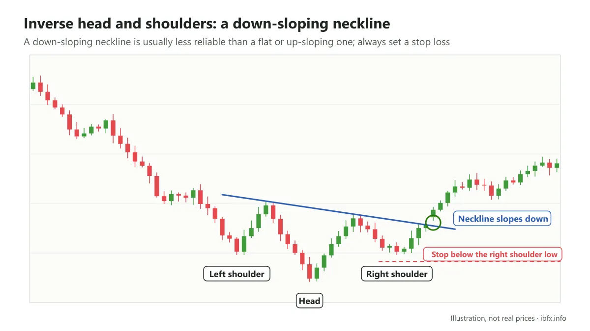 Illustration of an inverse head and shoulders with a down-sloping neckline, a less reliable signal; the stop goes below the right shoulder low
